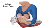 Illustration demonstrating the use of a breast pump